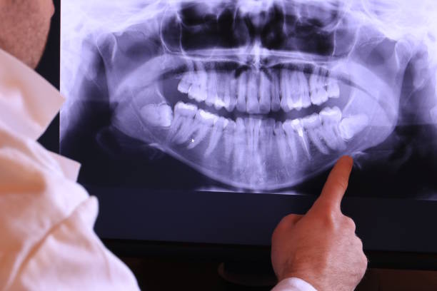 Best Emergency Dental Surgery in Lindstrom, MN